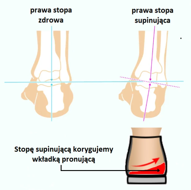 Supinacja grafika.png
